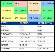 12 lead cheat sheet cardiac nursing icu nursing family