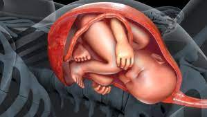 Anterior Placenta Your Basic Questions Answered Babyinfo