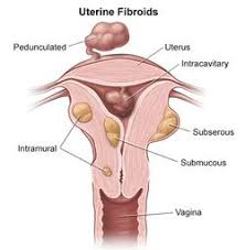 Pin On Pathology Definition