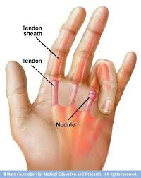 Pin On Health Conditions Research Remedies
