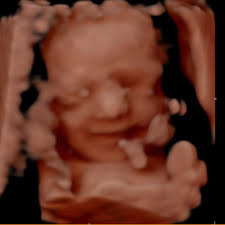 Kaitlyn and Matthew Magner's Baby Registry at Babylist