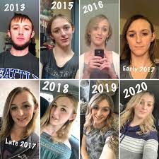 You young ones are fortunate, and have better results from hrt, than when one such as myself that started much later in life. Pin On S
