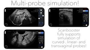 It is illegal for you to distribute copyrighted files without permission. Scanbooster Ultrasound Sim For Android Download Free Latest Version Mod 2021