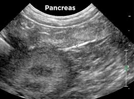 Thankfully, pancreatic cancer is relatively rare in dogs, but the most common types are adenocarcinomas and insulinomas. Small Animal Abdominal Ultrasonography Today S Veterinary Practice