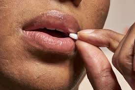The herpes virus can spread to your fingers and cause a type of infection known as herpes whitlow. Can You Pop A Cold Sore Hims