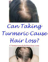 Essential Oils For Hair Loss Forum Which Specialist To Consult For Hair Loss W Oil For Hair Loss Hair Loss Body Hair Loss