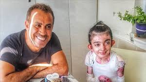 Yardımsever rock şarkıcısı olan haluk levent aslen adanalı ve 52 yaşında. Kelebek Kiz Elfida Yi Kaybettik