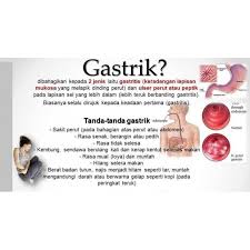 Ia boleh berlaku secara mengejut. Hawfi Plus Stokis Sah Ubat Gastrik Sakit Perut Hati Kronik Gerd Pedih Ulu Hati Sesak Nafas Shopee Malaysia