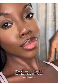 Golden Lips: Embracing Natural Beauty in Las Vegas