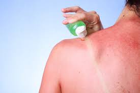 Webmd explains how to treat cracks, breaks, and blisters so they heal faster. How Long Does A Sunburn Last And Is There Any Way To Make It Heal Faster Health Com