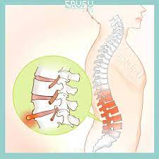 Slip disc adalah keadaan di mana intervertebral disc di tulang belakang memberi tekanan kepada saraf di spinal cord. 18 Best Slipped Disc Treatment In Malaysia Price Guide Reviews