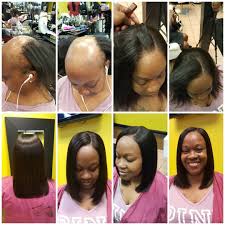 A Texas Hair Stylist Named Mr A Is Getting A Lot Of Credit On Social Media For His Amazing Glow Up Tr Hair Loss Women Black Women Hair Loss Black