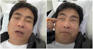 Bong Revilla gets into accident while filming new movie; needs surgery -  KAMI.COM.PH