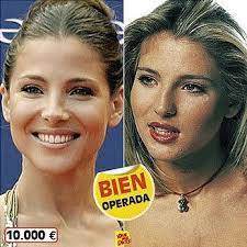 We don't seem to need her admission. Elsa Pataky Not Pinning To Shame Her It S Just Nice To Have A Visual Reminder Every Once In A While T Maquillaje Antes Y Despues Rinoplastia Cirujia Plastica