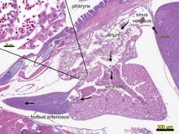 The venous side of the heart is preceded by an enlarged chamber called the sinus venosus. Fish Cardiovascular Physiology And Disease Sciencedirect