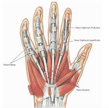 Tendon contractures of the hand. Flexor Tendon Injuries Fife Virtual Hand Clinic