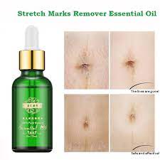 Stretch Marks Remover Atherisches Ol Hautpflege Behandlung Creme Fur Stretch Mark Entfernung Mutterschaft Slackline Fur Schwangere Ole Stretch Marks Remover Stretch Marksmarks Remover Aliexpress