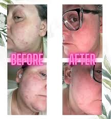 Ready to learn more? Reach out via DM.