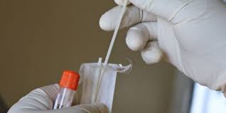 Ocu in spain, a spanish consumer association, estimates that the average cost of a pcr test is eur120. Spain Will Request A Negative Pcr Global Mobility Blog Duguech Dip