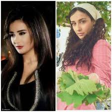 وعندما بدأت عمليات التجميل بالليزر كانت تقتصر على تجميل البشرة، أما الآن فهي تمتد لتشمل الكثير من عمليات التجميل التي. ØµÙˆØ± Ù…ÙØ§Ø¬Ø¦Ø© Ù„Ù€ 22 ÙÙ†Ø§Ù†Ø© Ø³ÙˆØ±ÙŠØ© Ù‚Ø¨Ù„ ÙˆØ¨Ø¹Ø¯ Ø¹Ù…Ù„ÙŠØ§Øª Ø§Ù„ØªØ¬Ù…ÙŠÙ„