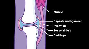 Rheumatoid Arthritis Causes Symptoms Treatments