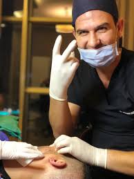 Dr Hair Hair Transplantation Turkey Sac Ekimi Transplante Capilar Trassiz Sac Ekimi Sac Dokulmesi Sac