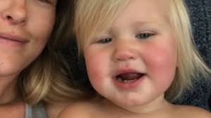 What happened to bode miller's daughter emeline? Olympic Skier Bode Miller S Daughter Emmy Drowns In Accident At Pool Party Metro News