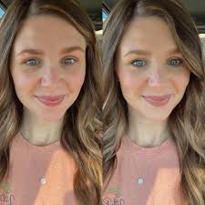 Coverage of rosacea, acne, hyperpigmentation, and dark circles