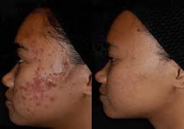 Not only does she know her stuff but her wide range of . Maxaesthetics Med Spa The Best Medical Spa Skincare In Philadelphia Pa