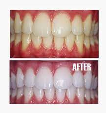 Natural Solution To Whiten Your For A Quick Way To Whiten Your Teeth In The Morning Sprinkle Baking Soda Into Your Health And Beauty Beauty Hacks Diy Beauty