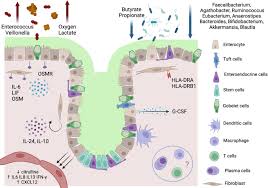 Image result for Neutropenic Colitis