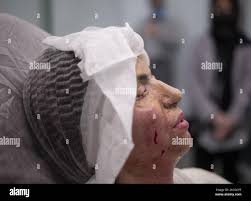 One attack is one attack