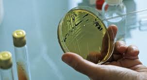 Denrees Alimentaires Criteres Microbiologiques D Hygiene Des Procedes Ministere De L Agriculture Et De L Alimentation