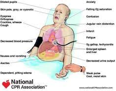 Body parts aroung the chest : Body Parts
