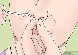 The septum can become damaged in several ways, leading to complications. Sich Ein Septumspiercing Machen Lassen 9 Schritte Mit Bildern Wikihow