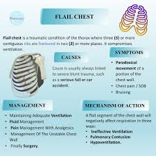 Image result for Flail Chest