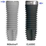 Partes de los implantes: implantes buenos, implantes de calidad