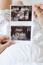Baby & kopf heben » meilensteine in der babyentwicklung: Geschlecht Des Babys Bestimmen Ab Wann Familie De Baby Geschlecht Ultraschall Baby Baby Geschlecht Ultraschall