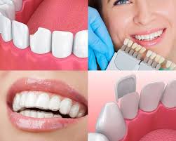 · dental bonding · veneers · crowns · enamel shaping · orthodontics (braces) · types of braces. Cosmetic Dentistry Fairfax Va Fairfax Family Dental Care