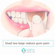 Pin On Surya Dental Care