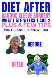 Diet After Gastric Sleeve Surgery What I Ate Weeks 1 2 Plus A Few Tips Video In 2020 Gastric Sleeve Surgery Gastric Sleeve Diet Sleeve Surgery Diet