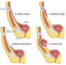 Image result for Umbilicus botryoides
