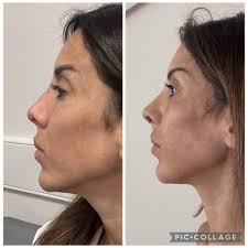 My Experience with Eight PS and Dr. Kim Han Jo