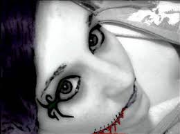 Has the scars of a glasgow grin in peaky blinders. Chelsea S Smile By Euphoric Suicide On Deviantart