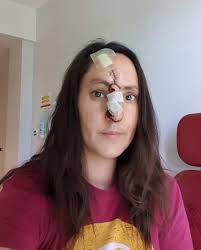 Responsible for the hairy creation is reportedly instagram's gret_chen_chen, who has inspired other beauty lovers to adopt the trend. Tanning Addict Who Shunned Sun Cream Has Tip Of Nose Cut Off After Tiny Pimple Turned Out To Be Skin Cancer