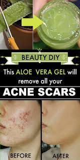 Pin On Clear Skin Products