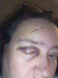 Rakai Wrong AF For That. I Just Know Sexyy Red Head Hurt 😳 🔻CC🔻