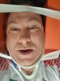 Didn't expect to end up like this after watching The reds beat  Peterborough. Taken out by an trunk