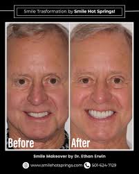 Ethan Erwin (@ethanerwin1) • Facebook