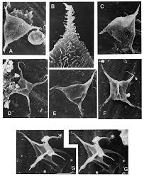 Image result for Acritochaete